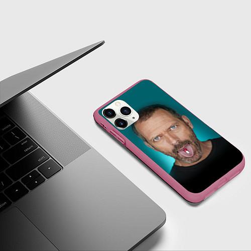Чехлы iPhone 11 series Доктор Хаус