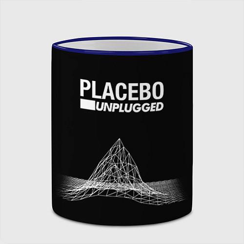 Кружки керамические Placebo